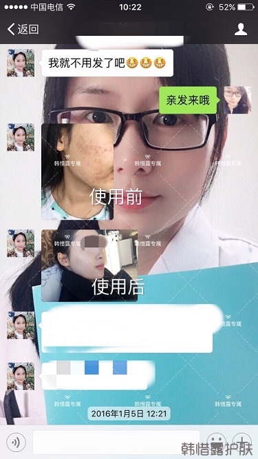 痘花妹變無(wú)暇美女