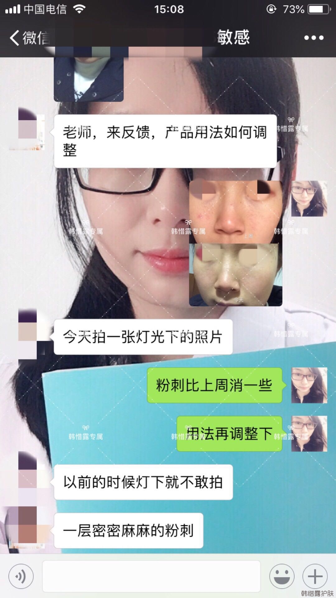 粉刺痘痘怎么有效去除？以前不敢拍燈光下照片，粉刺少了，現在敢了！